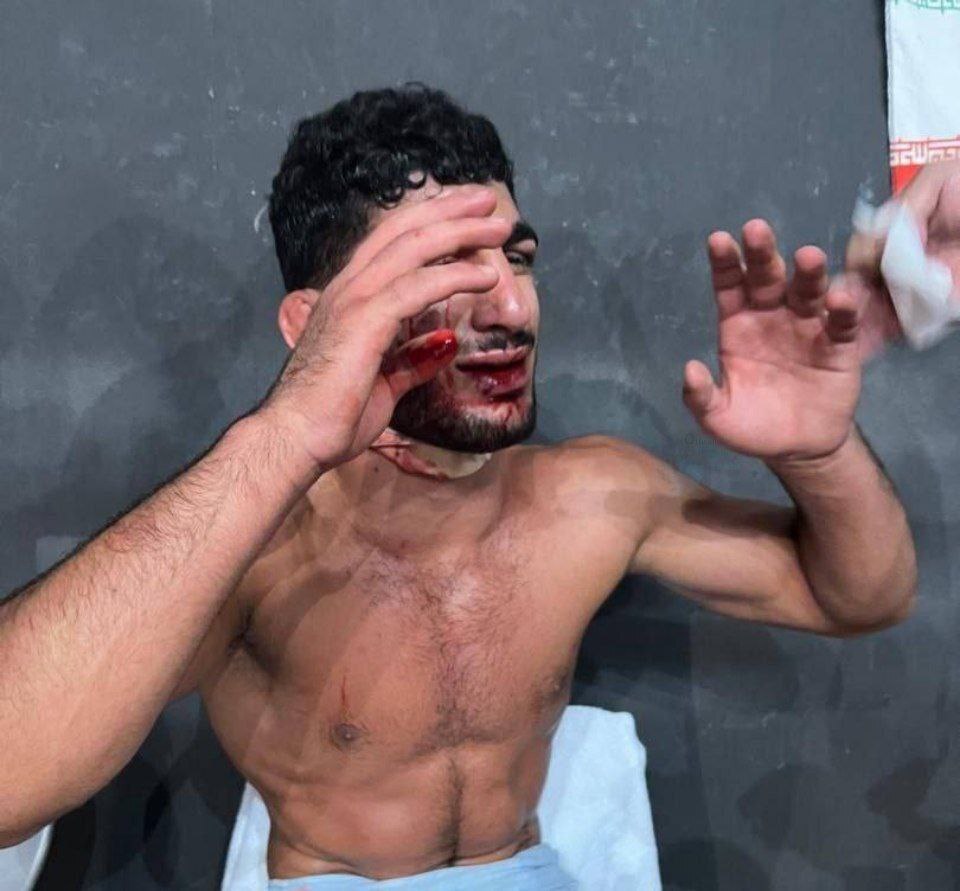 وضعیت دردناک دانیال سهرابی پس از شکست برابر حریف فرانسوی