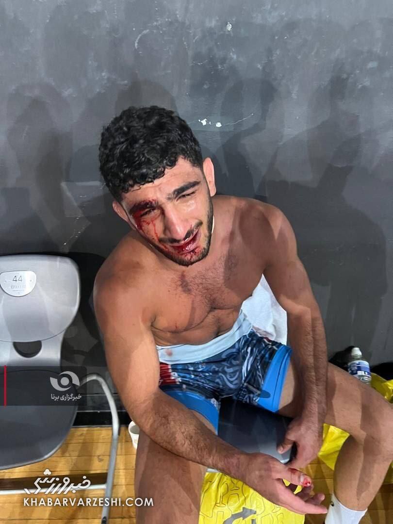 404579 مصدومیت دانیال سهرابی