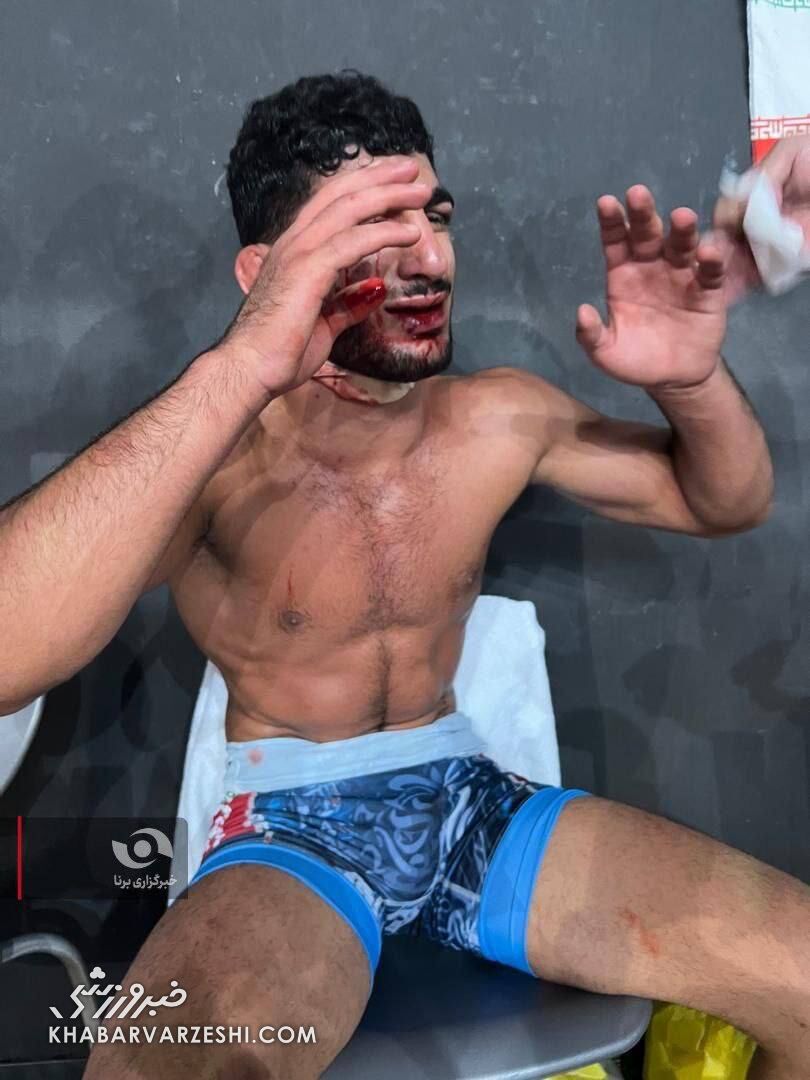 404580 خونریزی صورت دانیال سهرابی