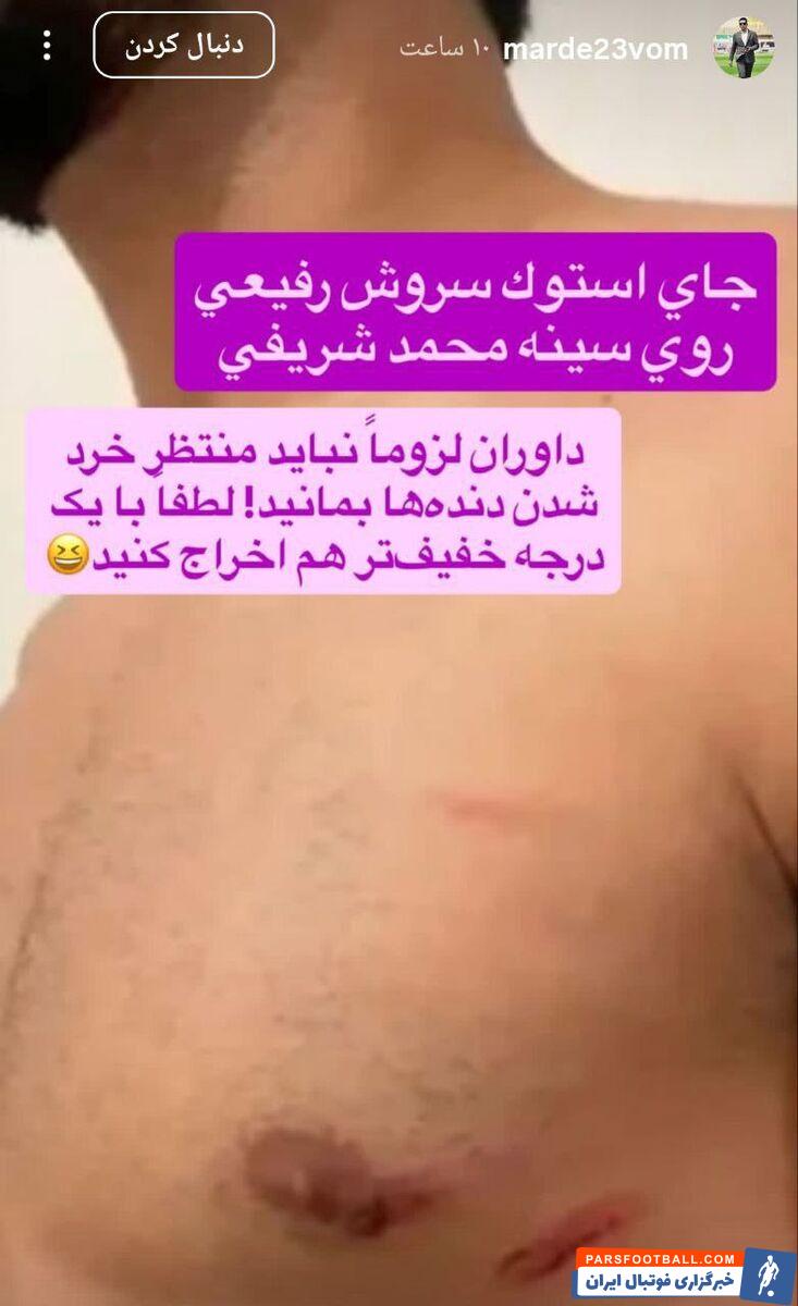 وحید صالحی کارشناس داوری : جای استوک سروش رفیعی روی سینه محمد شریفی