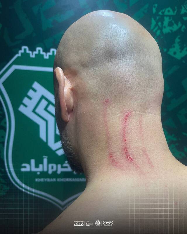 4555168 زخمی شدن مربی استقلال در پایان دیدار با خیبر +عکس