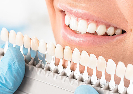 عمر کامپوزیت دندان چقدره؟