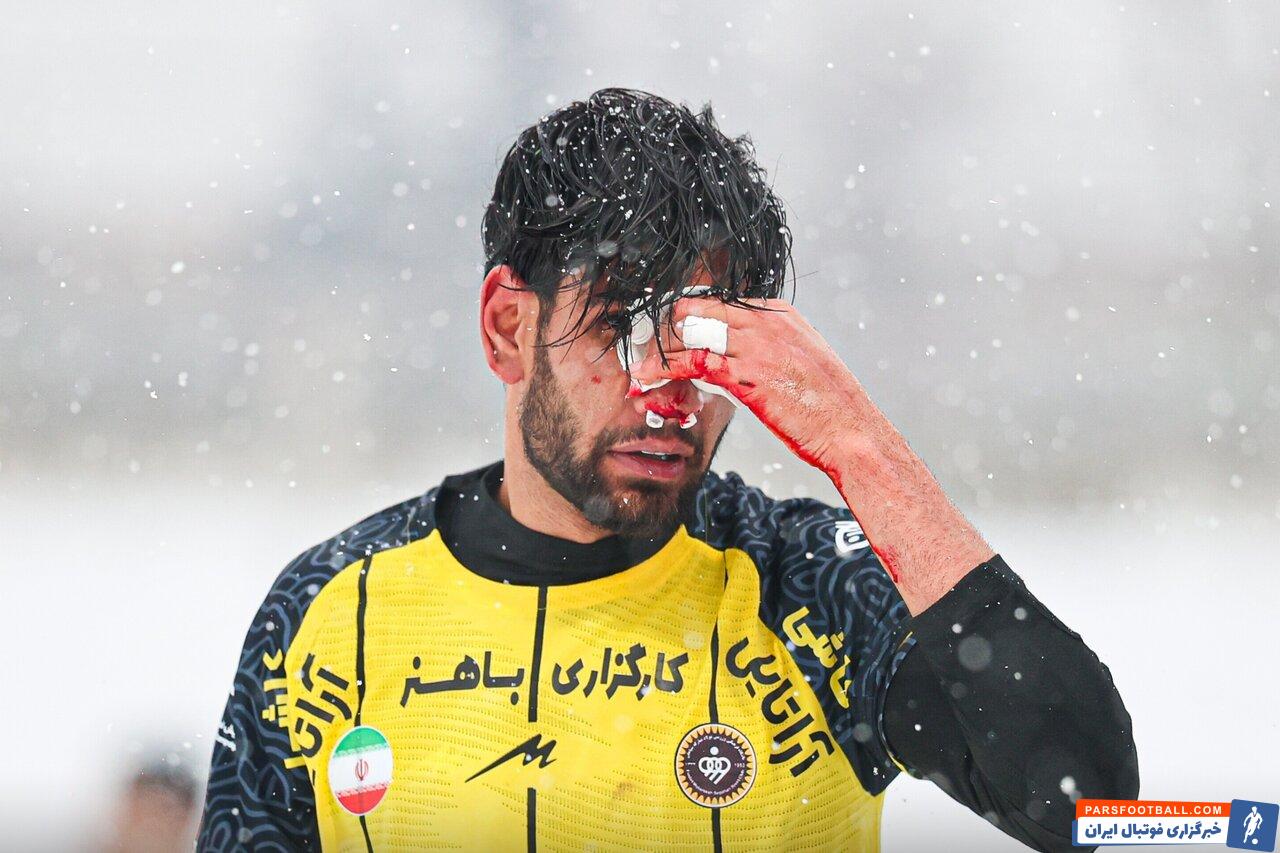 مصدومیت جدی مجید علیاری مهاجم سپاهان در دیدار با پرسپولیس