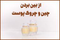 ازبین بردن چین و چروک پوست با ژل رویال