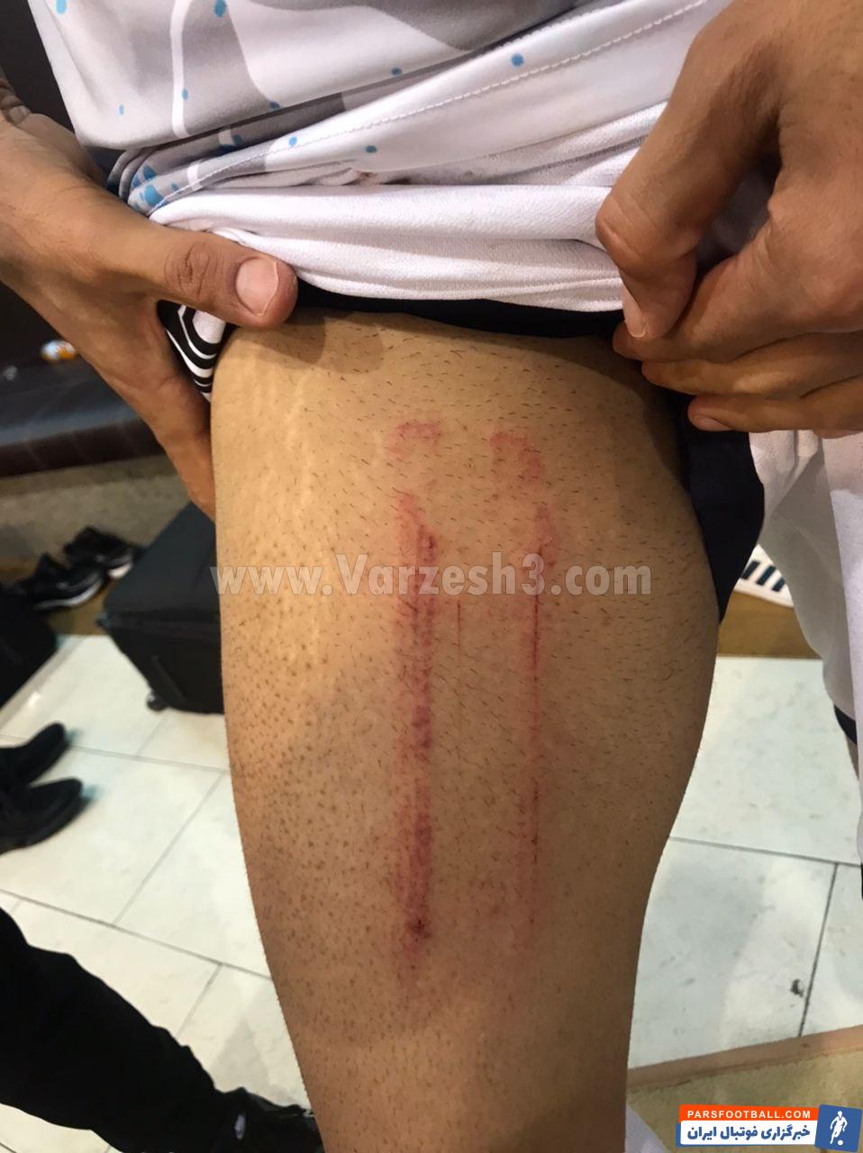 امید عالیشاه