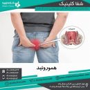 درمان بواسیر بدون درد در یک ساعت