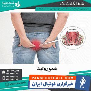 درمان بواسیر بدون درد در یک ساعت