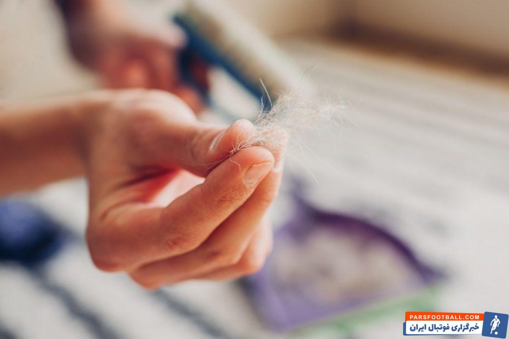 چگونه موهای روی فرش را جمع کنیم؟