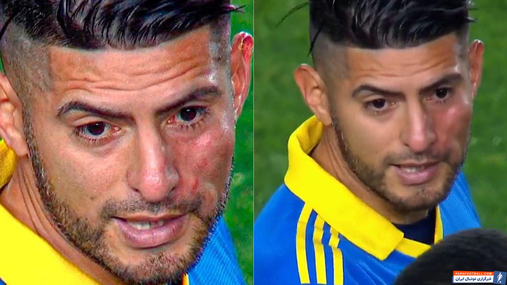 درگیری شدید دو بازیکن بوکا جونیورز با یکدیگر در لیگ آرژانتین