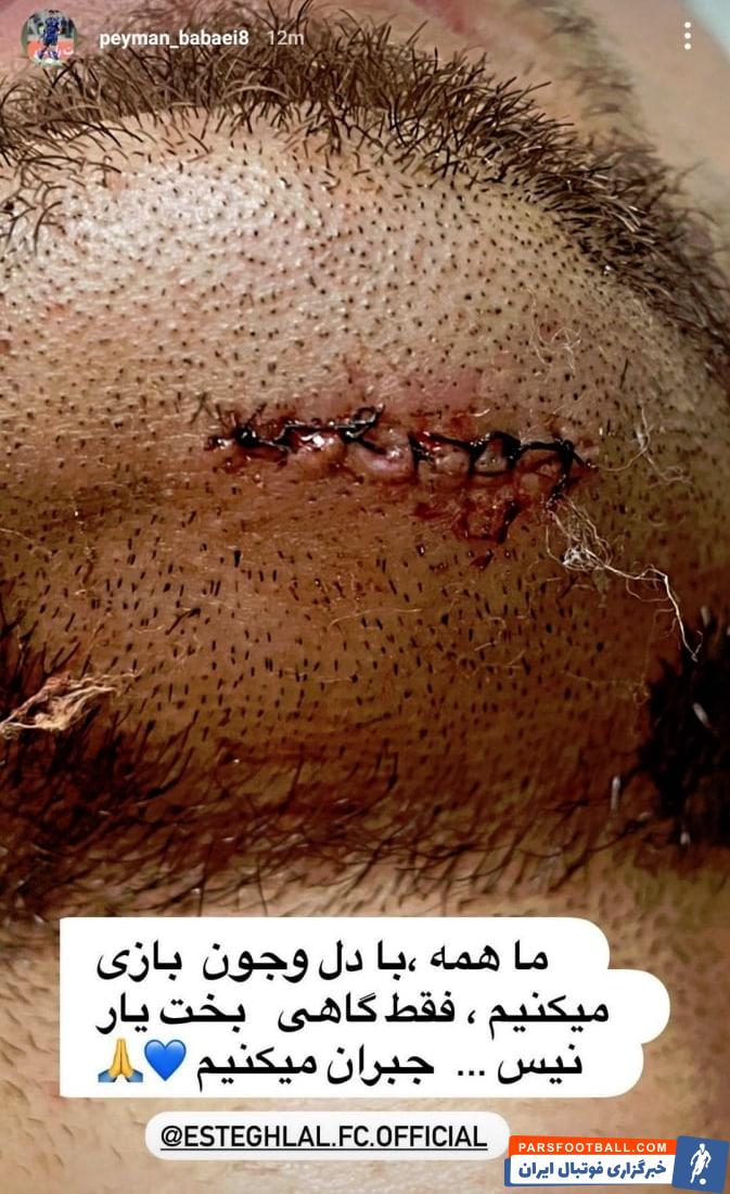 پیمان بابایی پس از مسابقه برابر پیکان دچار مصدومیت شد