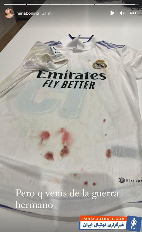 خونی شدن پیراهن فدریکو والورده در دیدار جنجالی رئال مادرید و اتلتیکو مادرید