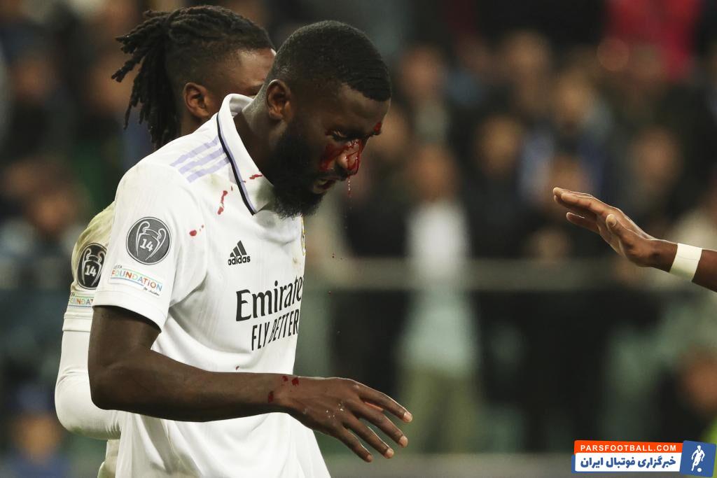 20 عمل بخیه روی صورت آنتونیو رودیگر برای رسیدن به ال کلاسیکو