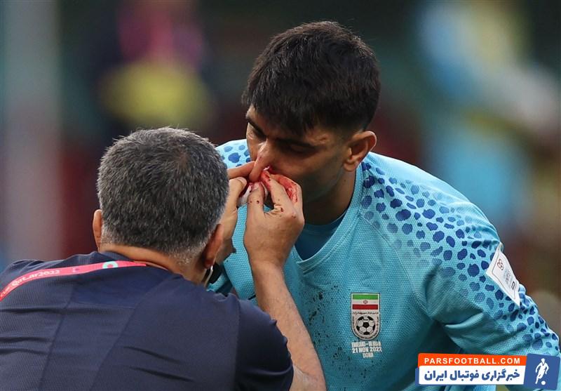 بیرانوند ؛ حضور بیراوند در تمرین تیم ملی با محافظ صورت و کلاه