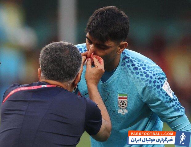 علیرضا بیرانوند در جریان تمرین امروز تیم ملی ایران در ورزشگاه الریان قطر غایب بود