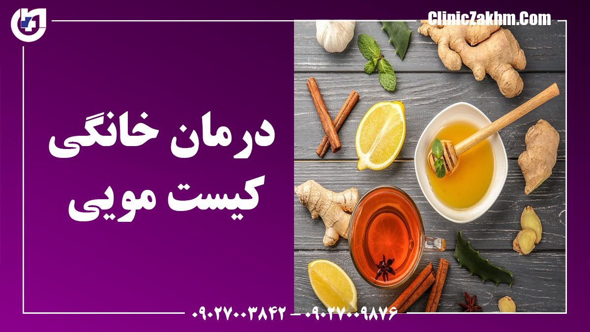 کیست مویی از علائم اولیه تا روش های درمان و مراقبت های بعد از آن
