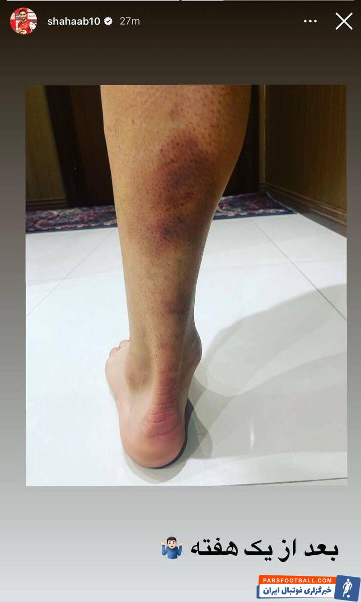 عکس| مصدومیت دردناک شهاب زاهدی مقابل فولاد/ پنالتی اخراج پرسپولیس اثبات شد؟
