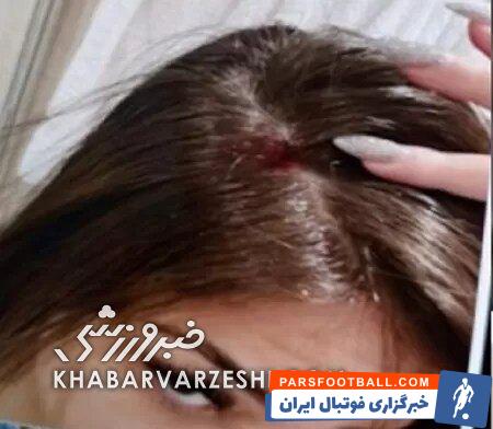 تصاویر| اتهامات تازه به آنتونی ستاره منچستریونایتد؛ او به نامزد باردارش حمله کرد!/ امیدوارم بمیری و بروی به درک!