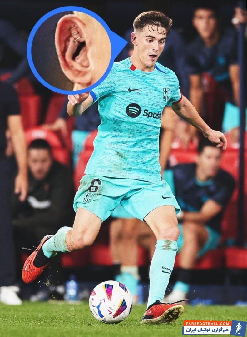 بارسلونا ؛ جراحت گوش گاوی در دیدار برابر اوساسونا و خوردن سه بخیه