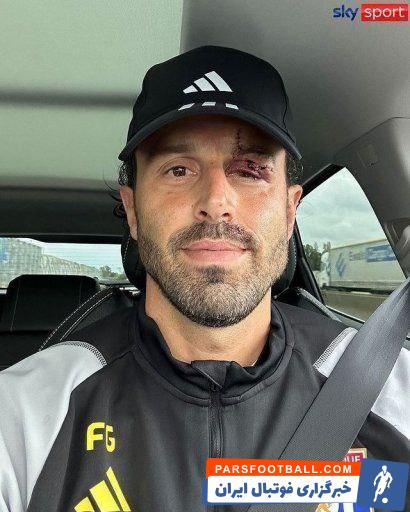 لیون ؛ فابیو گروسو با 13 بخیه در تمرینات لیون 