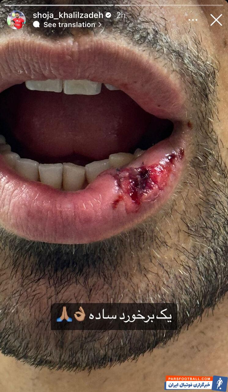 عکس| وضعیت خلیل‌زاده پس ضربه مهرداد محمدی