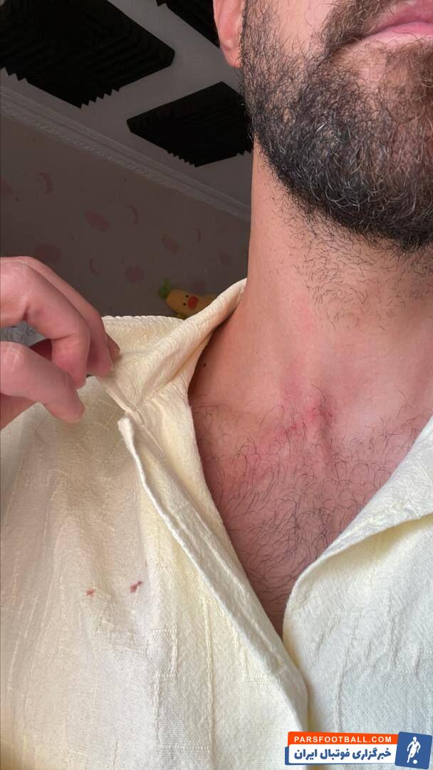 واکنش پلیس به حمله سارقان به مهاجم سابق استقلال