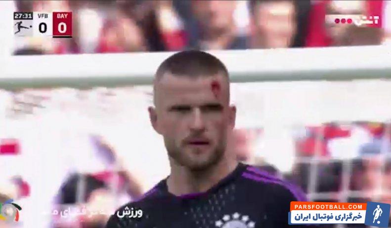 دایر ؛ آسیب دیدن سر اریک دایر پس از برخورد به شوت سرهو گیراسی