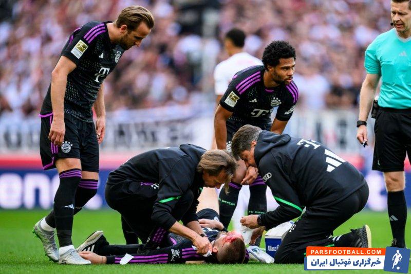 دایر ؛ آسیب دیدن سر اریک دایر پس از برخورد به شوت سرهو گیراسی