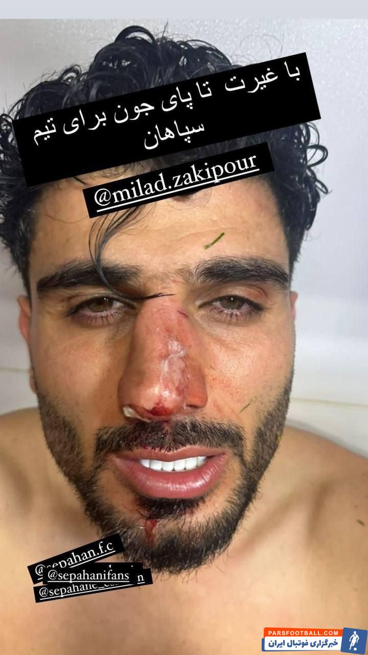 سپاهان ؛ جراحت شدید میلاد زکیپور بازیکن سپاهان از ناحیه بینی