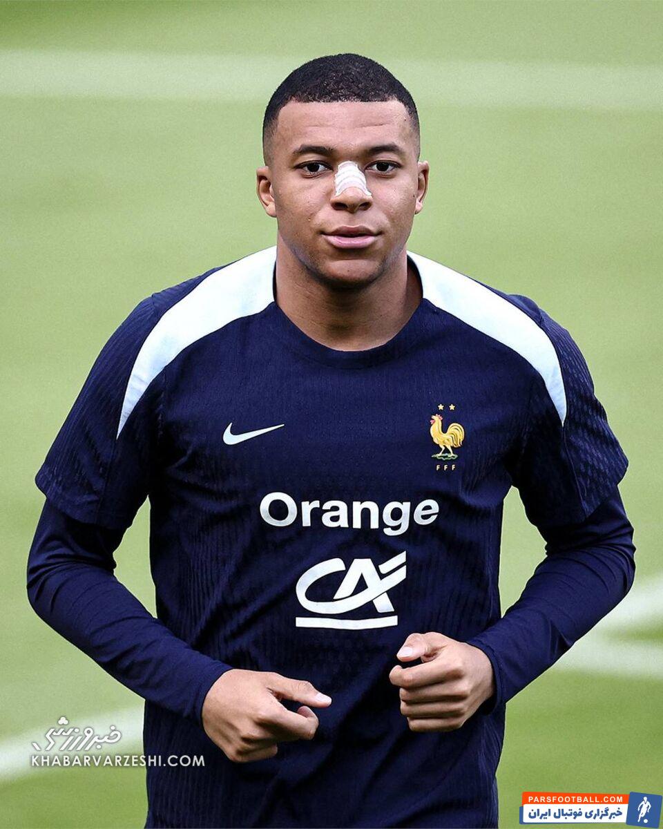 عکس| ظاهر جدید امباپه بعد از شکستن بینی