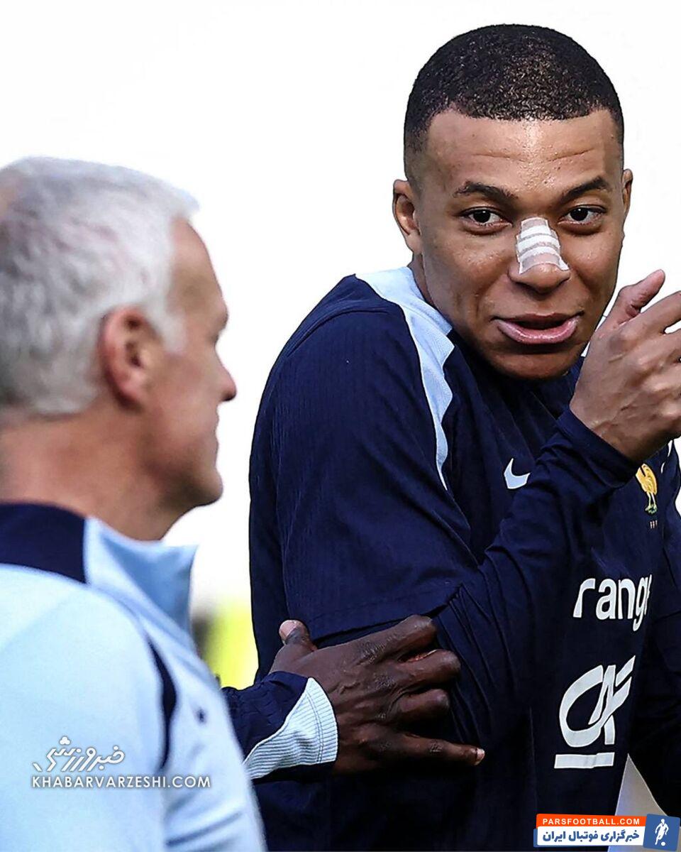 عکس| ظاهر جدید امباپه بعد از شکستن بینی