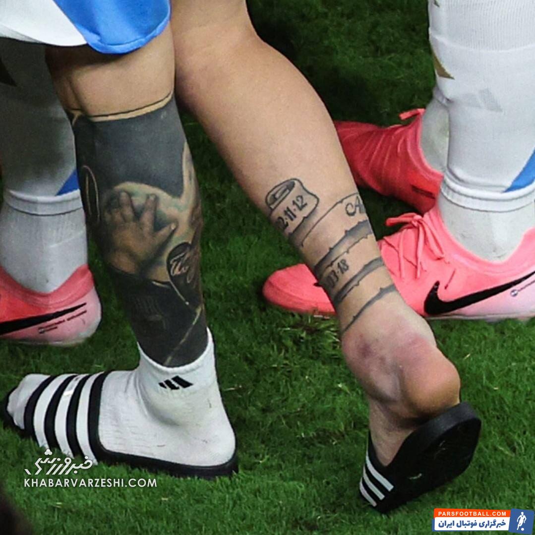 تصویری دلخراش از مصدومیت مسی/ مچ پای متورم اسطوره و اشک‌هایش در کوپا آمریکا +تصاویر