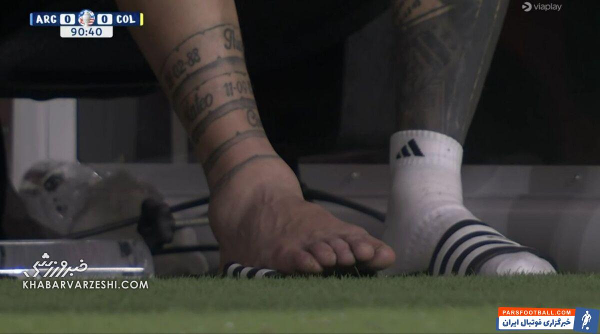 تصویری دلخراش از مصدومیت مسی/ مچ پای متورم اسطوره و اشک‌هایش در کوپا آمریکا +تصاویر