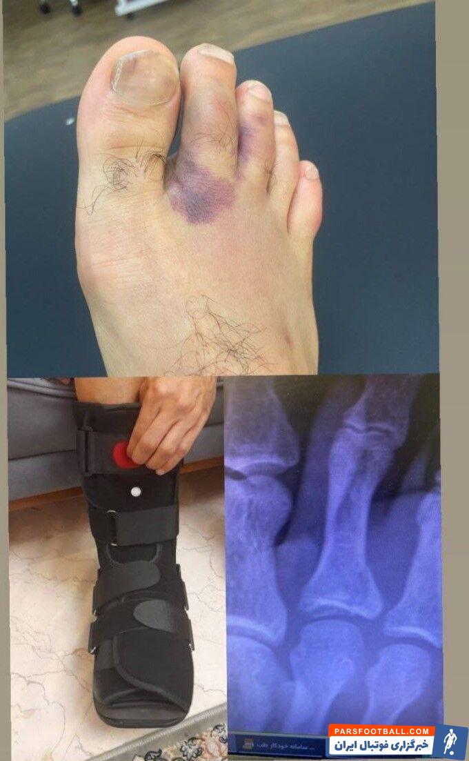 امید عالیشاه با مصدومیت سنگینی رو به رو شده است
