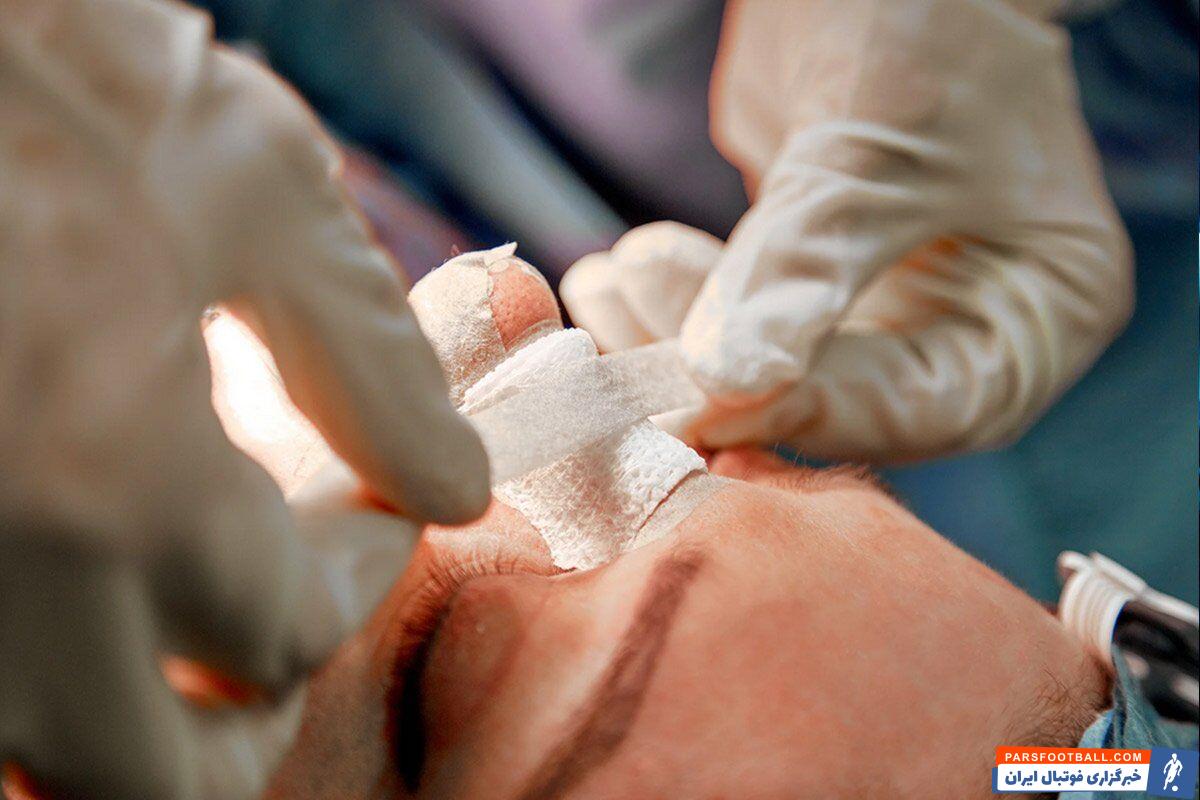 مراقبت‌های بعد از جراحی بینی