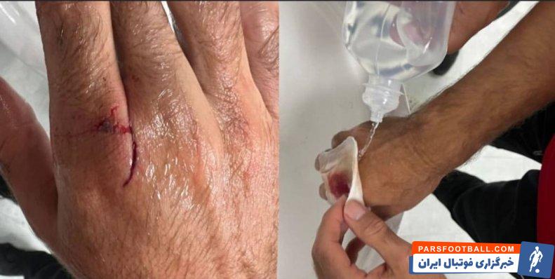 فرشاد فرجی در دربی مقابل استقلال با مصدومیت سختی مواجه شد