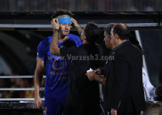 بلانکو ؛ تصویری از بلانکو با ابروی بانداژ شدهبه خاطر مصدومیت در داربی