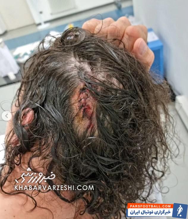 سر زلاتان را شکستند +عکس