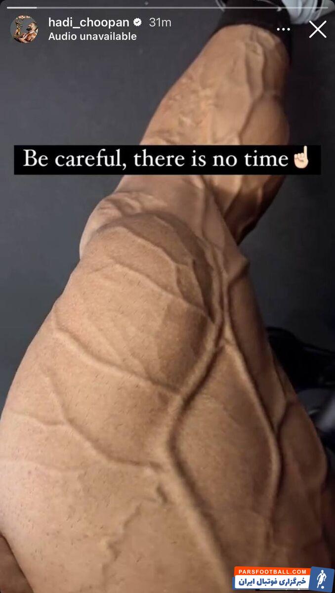 عکس| هادی چوپان نیامده رجزخوانی را شروع کرد