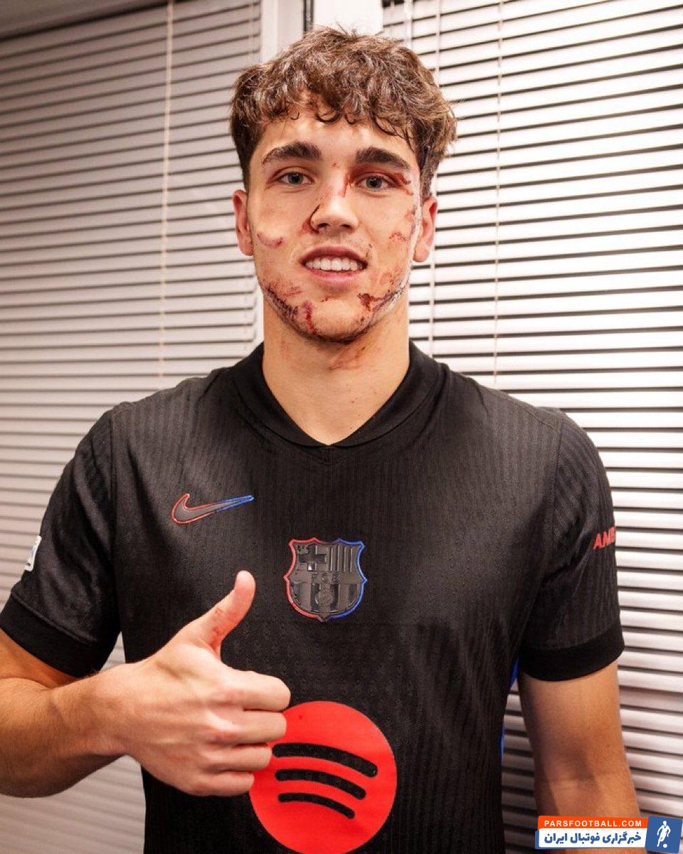 کوبارسی : صورتم ۱۰ تا بخیه خورده است؟ برای بارسلونا همه چیزم را هم می‌دهم