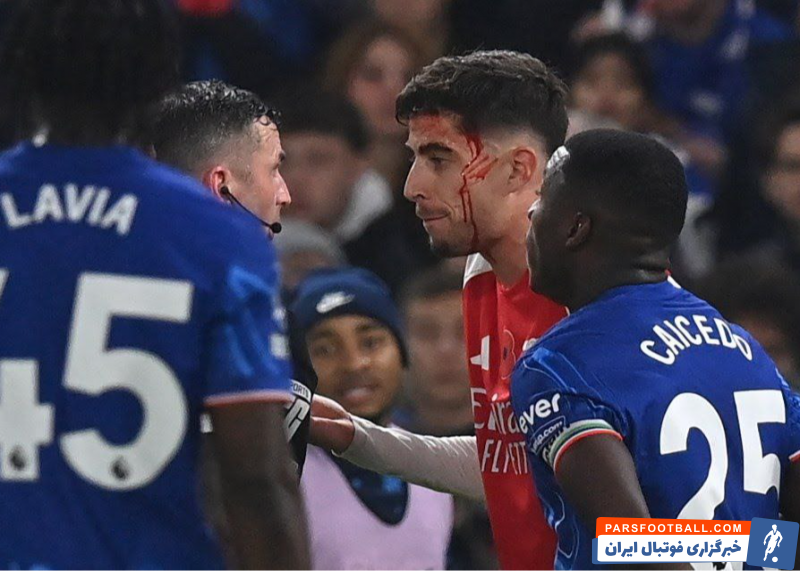 هاورتز ؛ تصویر خونریزی سر هاورتز ستاره آرسنال در دیدار برابر چلسی 