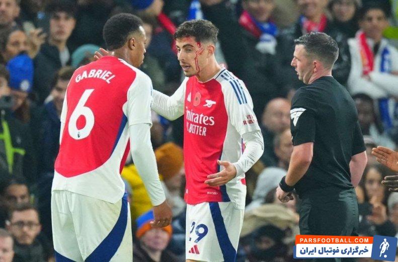 هاورتز ؛ تصویر خونریزی سر هاورتز ستاره آرسنال در دیدار برابر چلسی