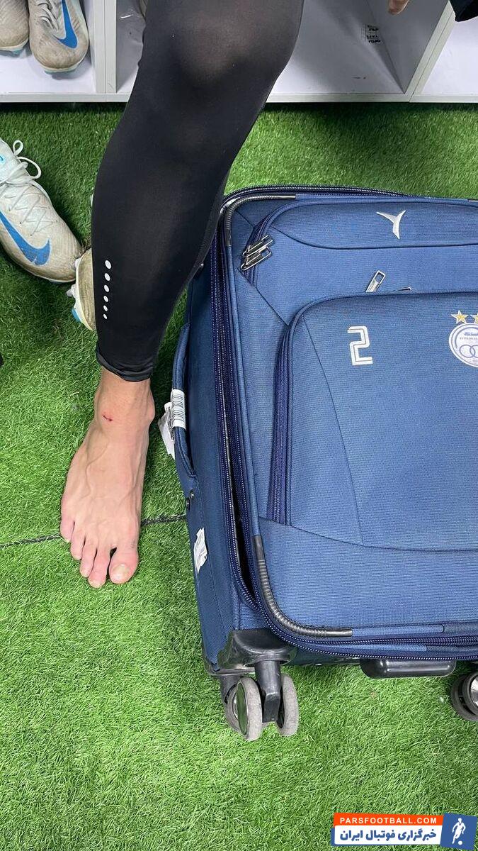 استقلال سند رو کرد؛ بازیکن آلومینیوم باید اخراج می شد / پای بازیکن استقلال بخیه خورد + عکس اختصاصی خبرورزشی