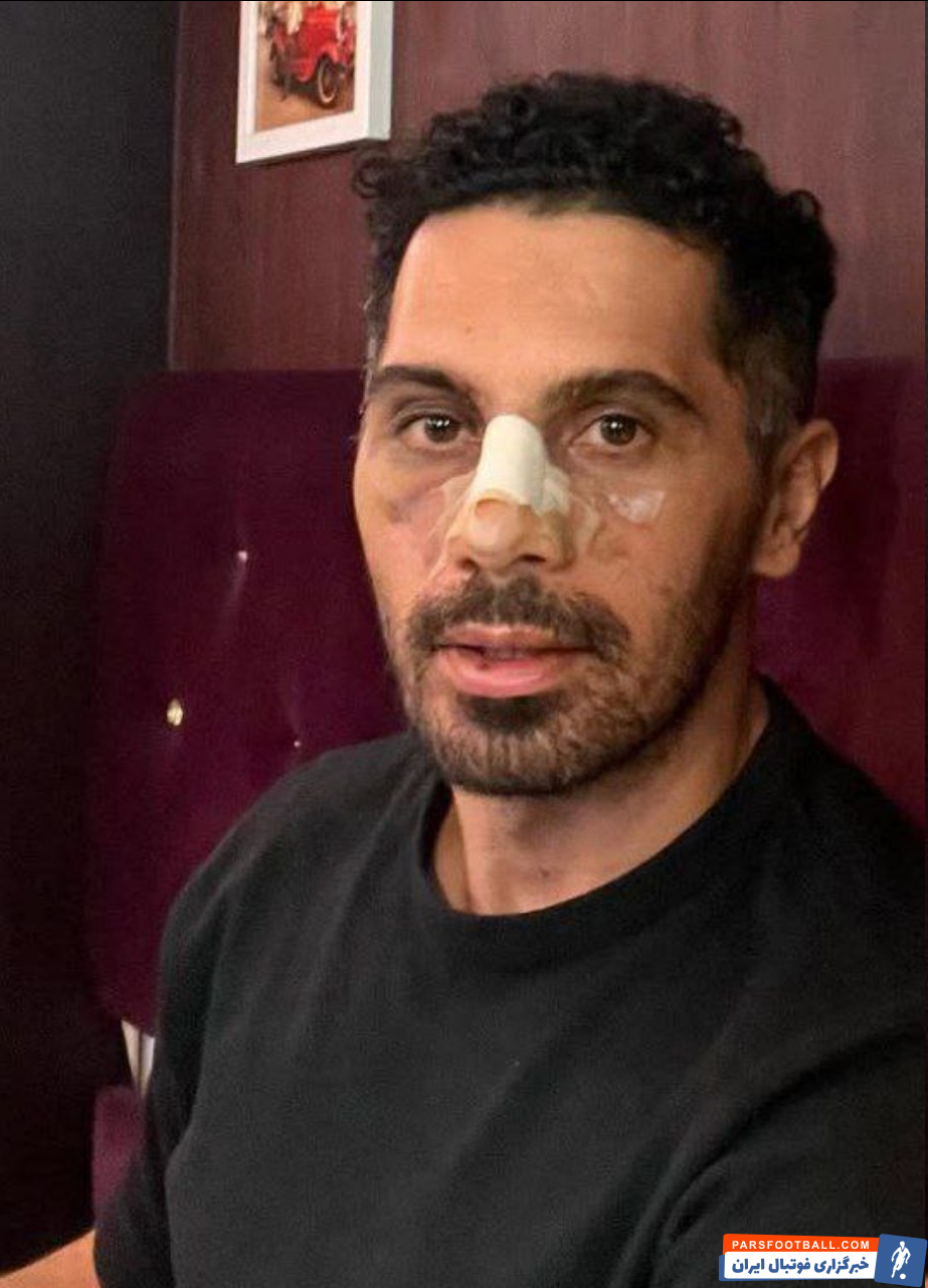 امید عالیشاه ؛ جدیدترین تصویر از کاپیتان پرسپولیس پس از مصدومیت