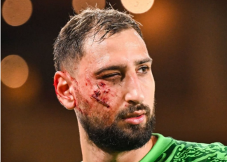 دوناروما ؛ تصویری از دوناروما گلر پاری سن ژرمن با بانداژ روی صورت