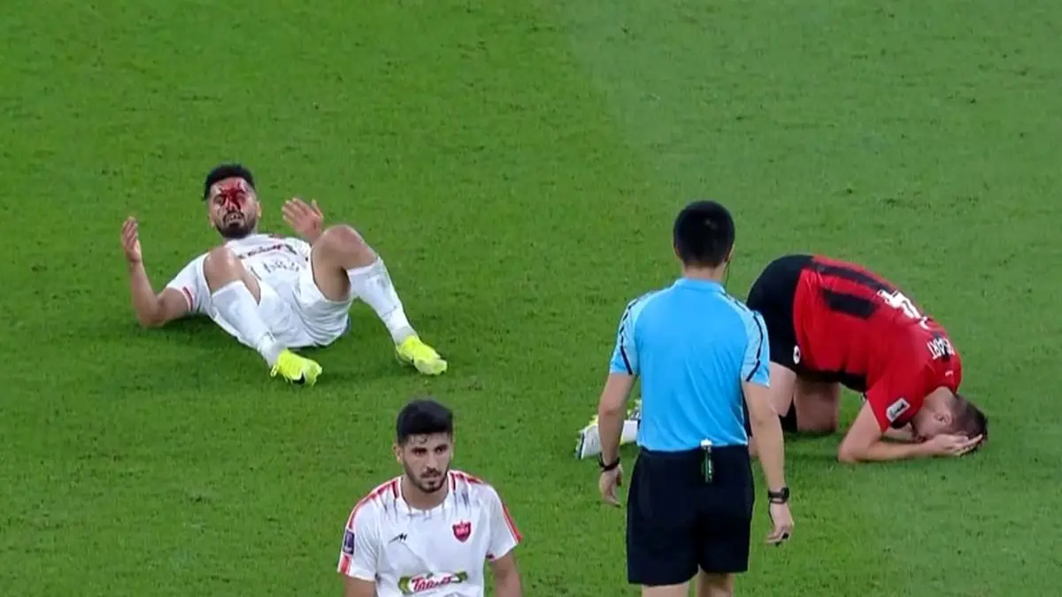 امید عالیشاه