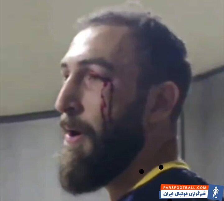 عکس| بزن بزن و کتک‌کاری در لیگ برتر