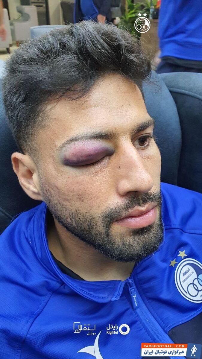 تکرار تاریخ برای سلیمی؛ ایمان دوباره از ناحیه چشم مصدوم شد