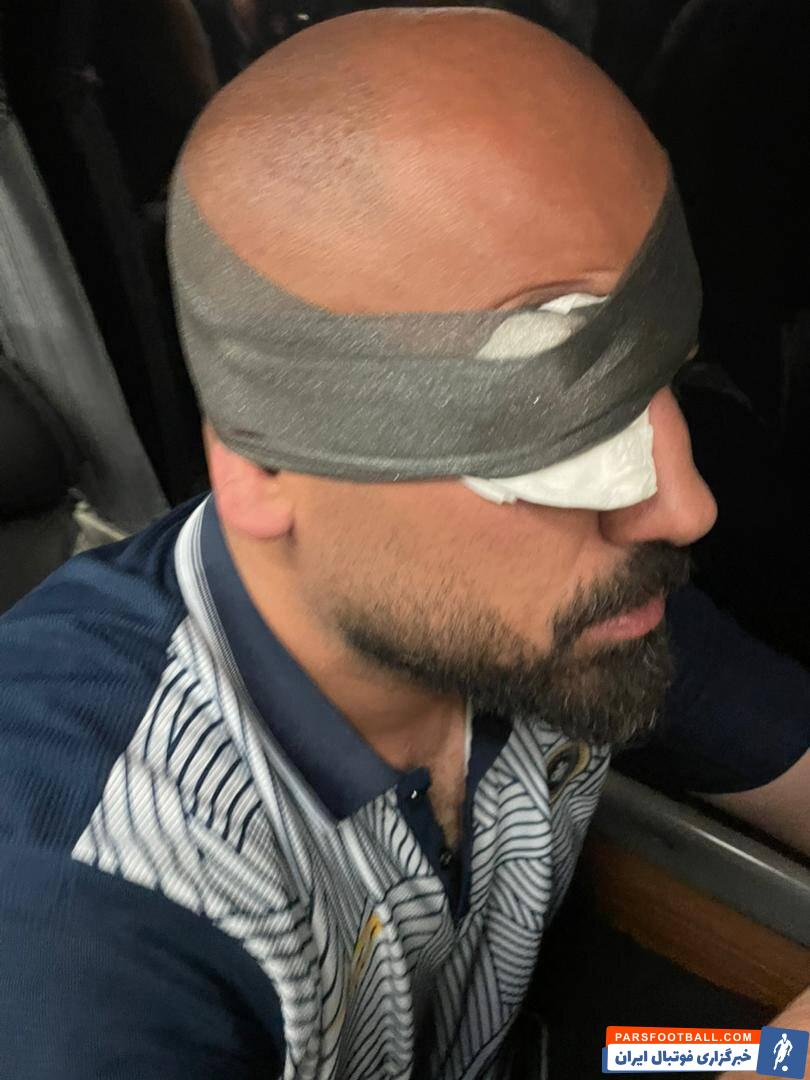 عکس | حمله هواداران یزدی به اتوبوس سپاهان