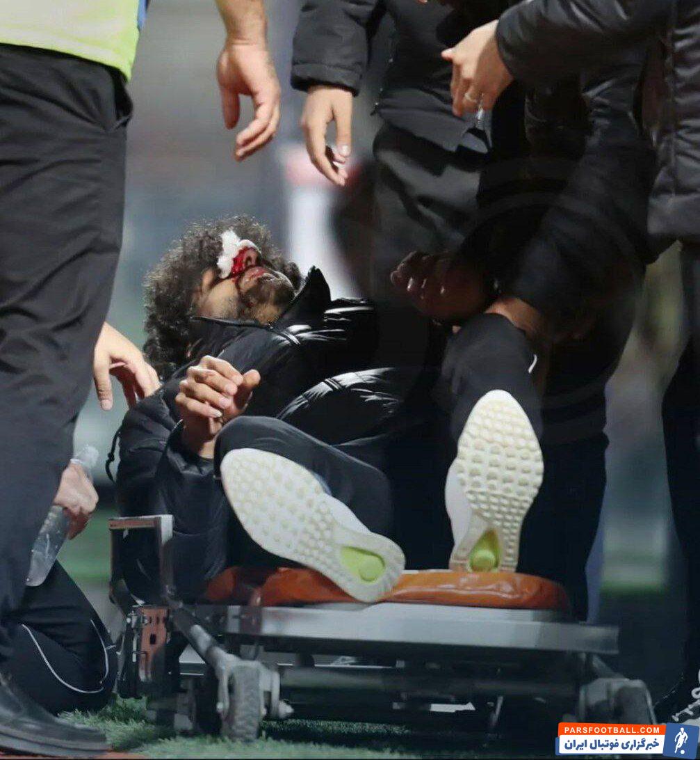 صورت زخمی با استقلالی رفت، با استقلال برگشت!