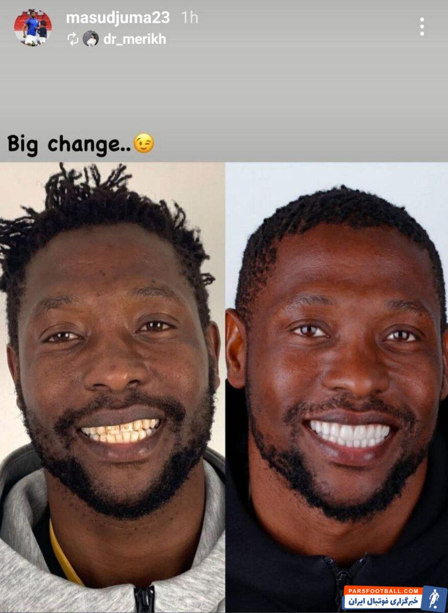 بازیکن جنجالی استقلال؛ عمل زیبایی به جای فوتبال بازی کردن! +عکس